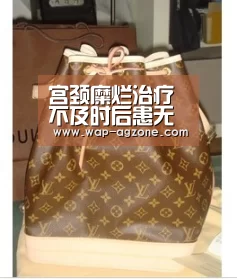 宫颈糜烂治疗不及时后患无穷:ag真人下载(图2) ag真人厅下载