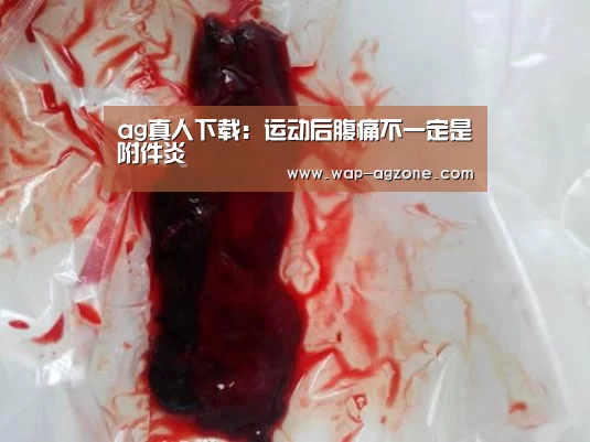 ag真人下载:运动后腹痛不一定是附件炎(图3) ag真人APP